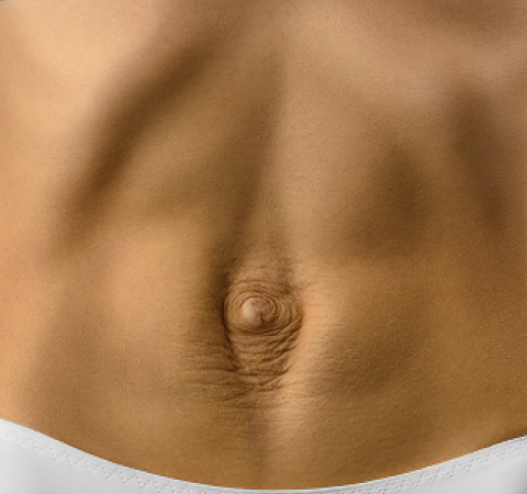 Fisioterapia Forte dei Marmi | Distasi addominale